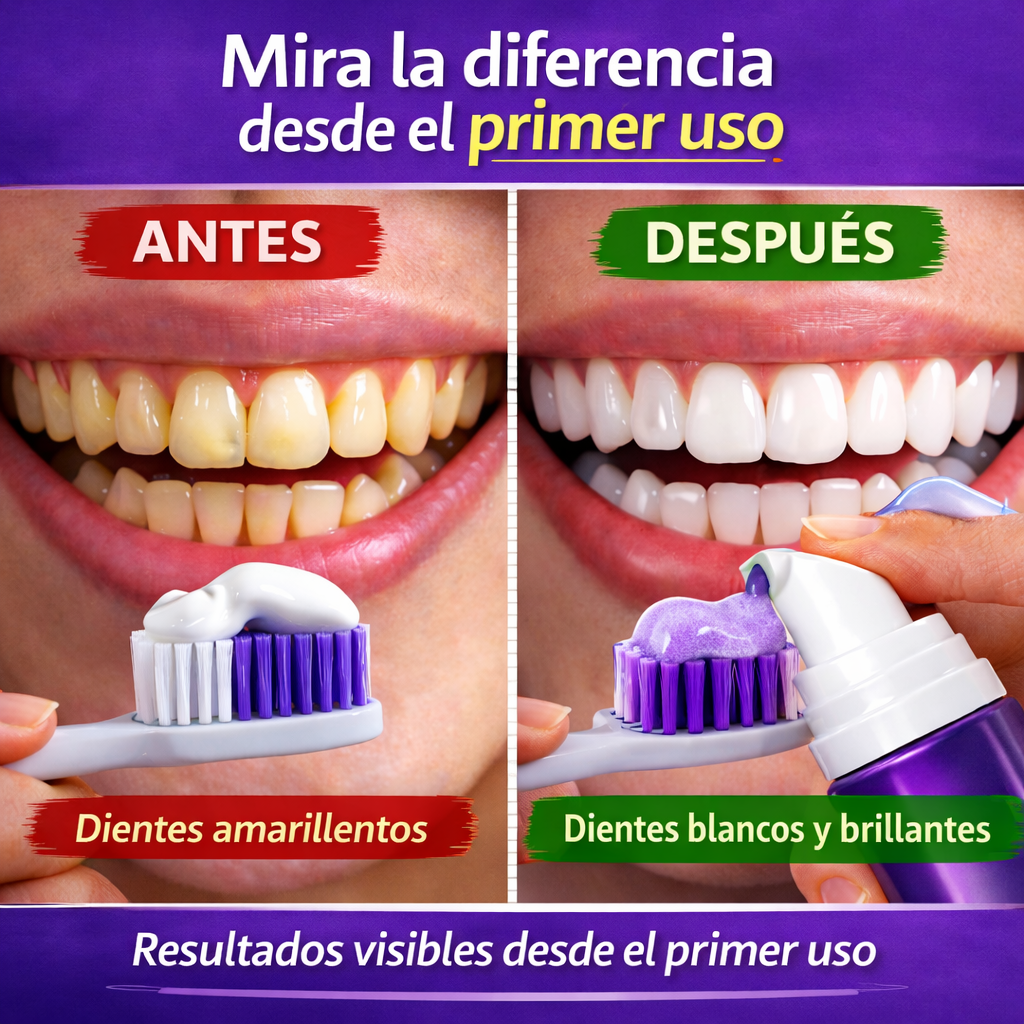 OBSESSIVE™ Blanqueador Dental – Recupera la Confianza en tu Sonrisa
