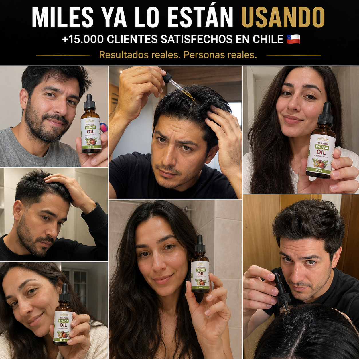 🌿Aceite Capilar Batana™ – Menos caída, cabello más fuerte